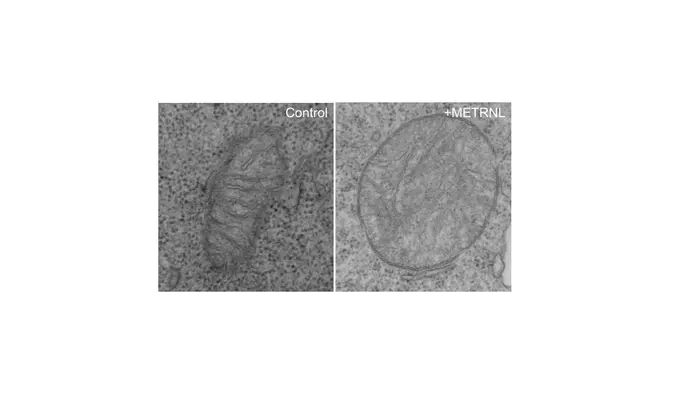 An unhealthy mitochondrion in a T cell exposed to METRNL