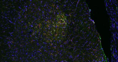 Immune Cells (1 of 2)