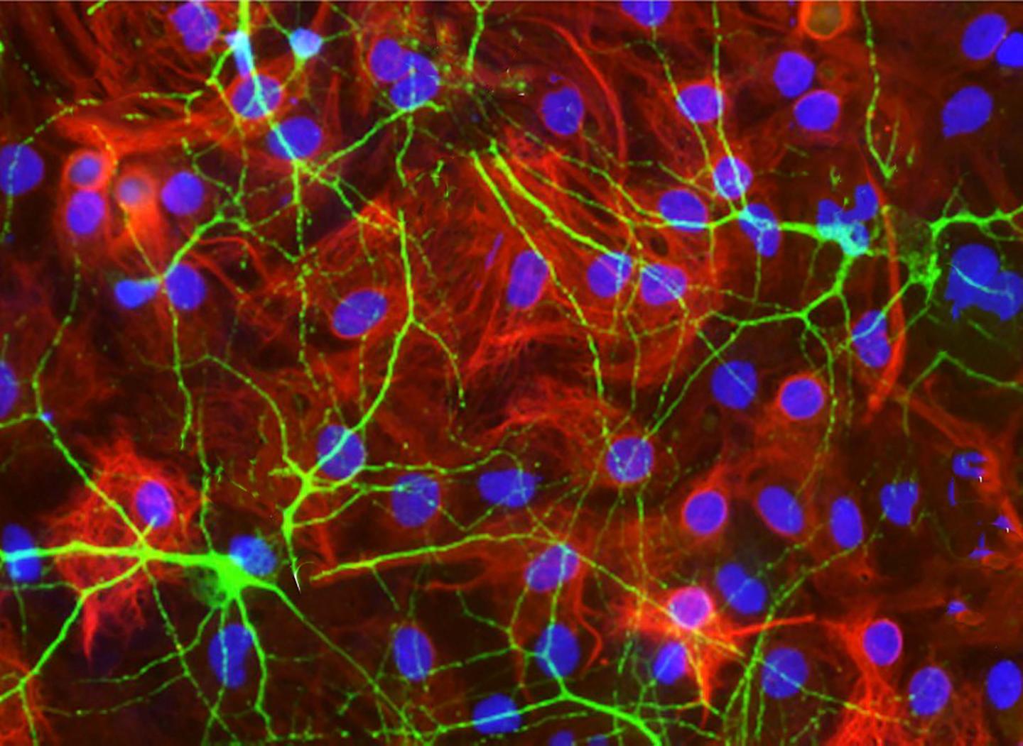 Healing a Bleeding Brain