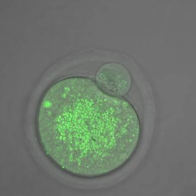 Obese mothers and children with metabolic diseases