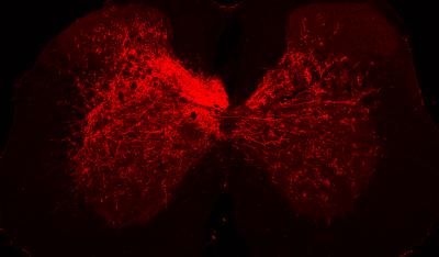 Therapeutic Cocktail 