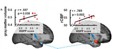 Brain Structure Predicts Personality Traits