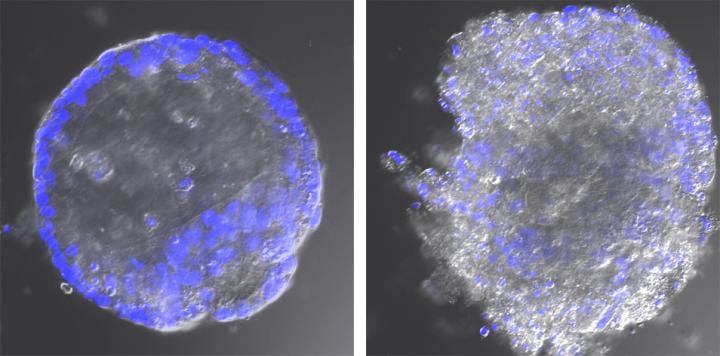 Normal and Infected Enteroid
