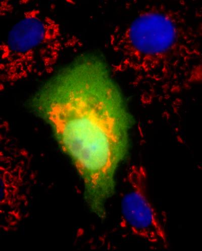Process of Cell Death