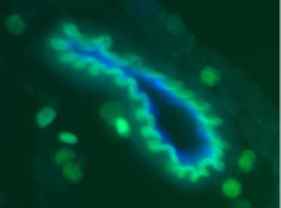 Leukemic and Chemokine Cells (1 of 2)