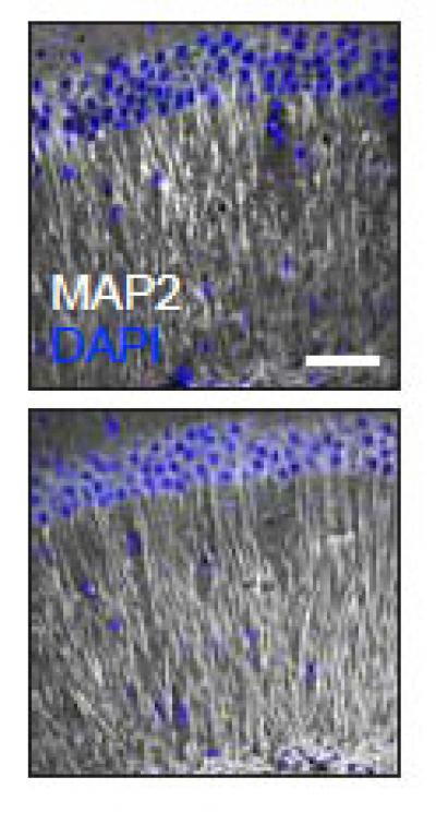 Abundance of Dendrite in the Hippocampus