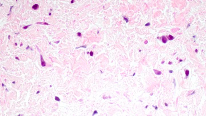 Pulmonary Vein Tissue