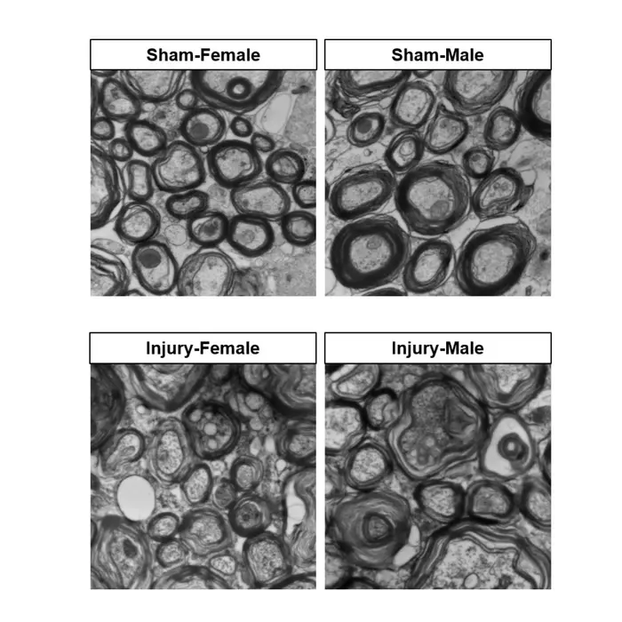 Female and Male Axons