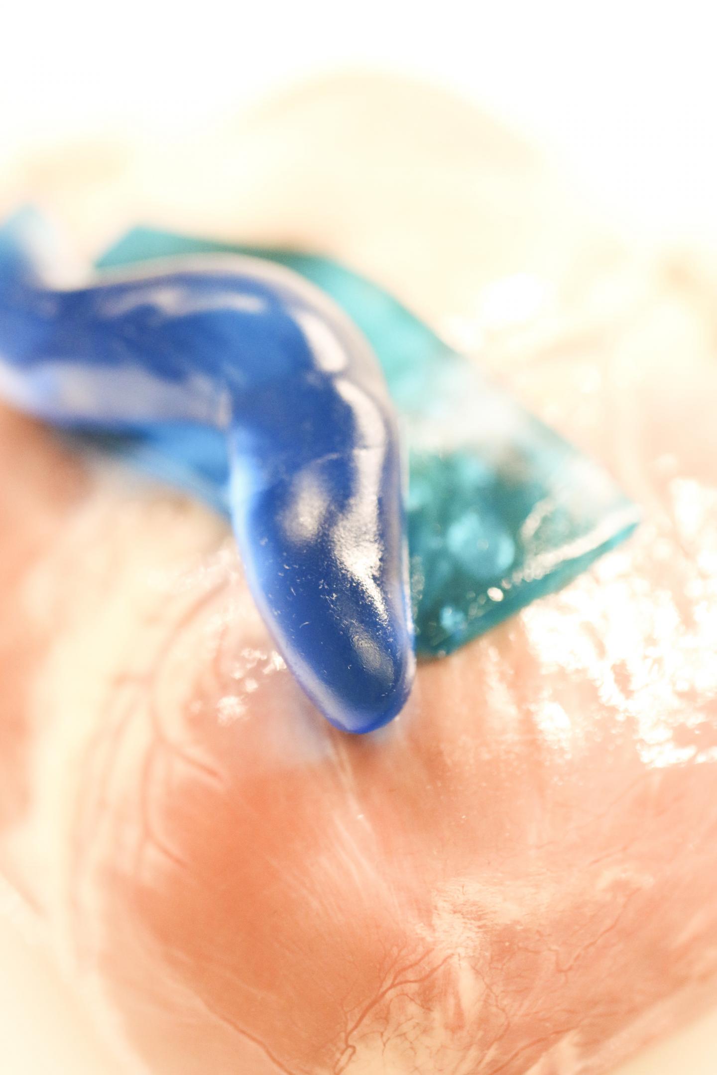 Tough Adhesive for Wound Healing