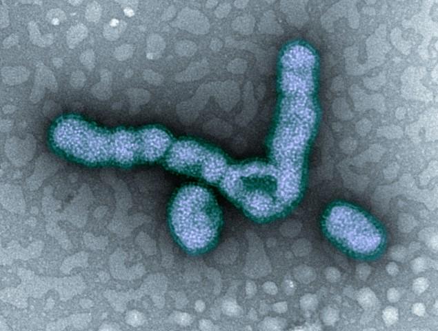 Transmission Electron Micrograph of H1N1 Virus Particles