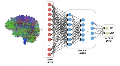 A Personalized Structural Connectome