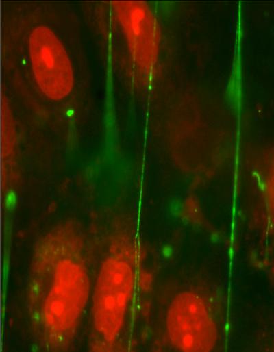 VWF is a Long, Thin Protein