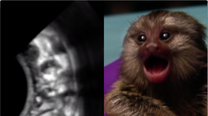 Marmoset fetus and infant