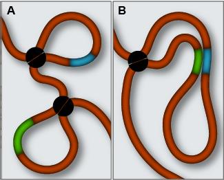 IDH-Mutant Tumor Image