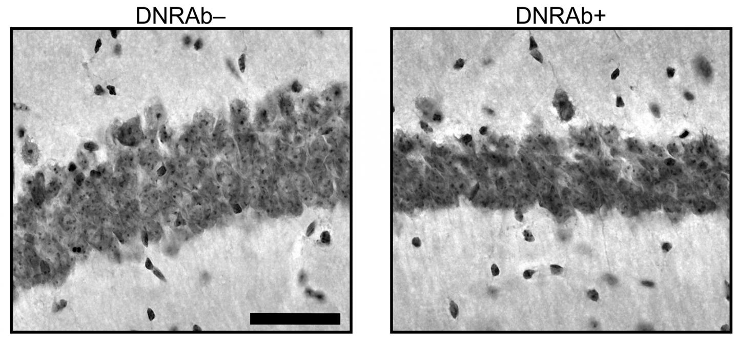 DNRAbs Reduce the Number of Neurons and Neuronal Connections