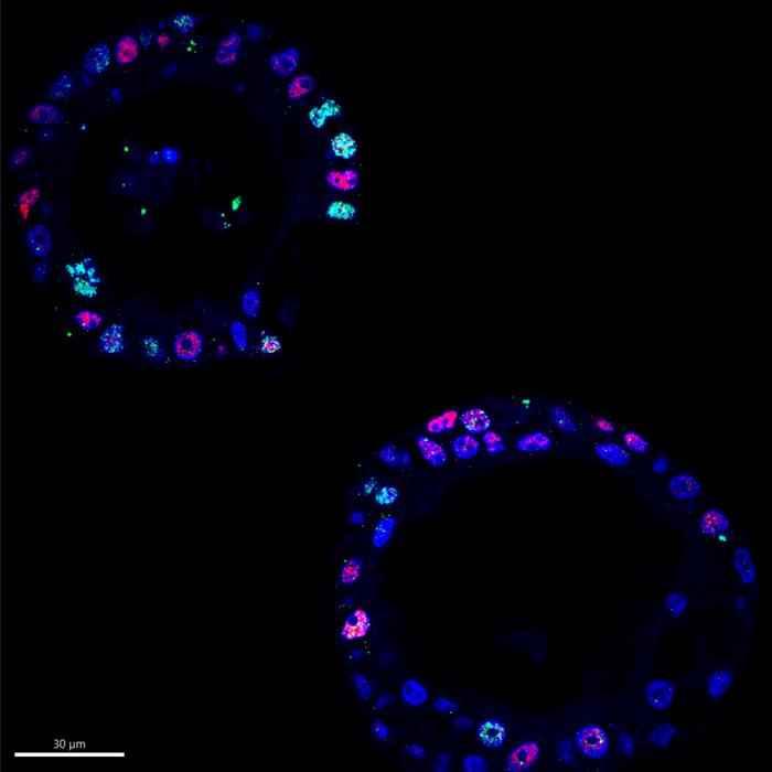 Higher MYC Levels Correlate with Increased DNA Damage in Cancer Cells