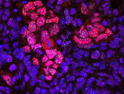 TRF1 Expression Increases During in Vivo Reprogramming