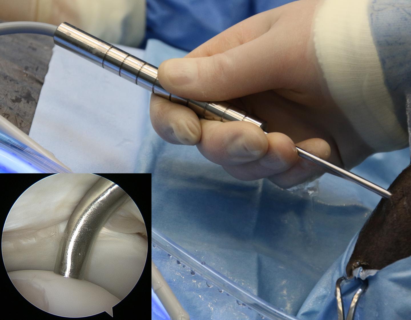 Novel Arthroscopic Probe