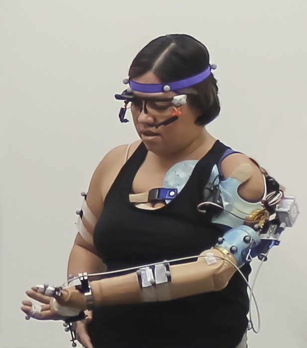 Participant with advanced prosthetic arm