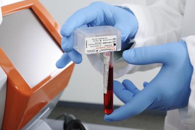 New Blood Test Detects Common Fungal Infection (2 of 3)