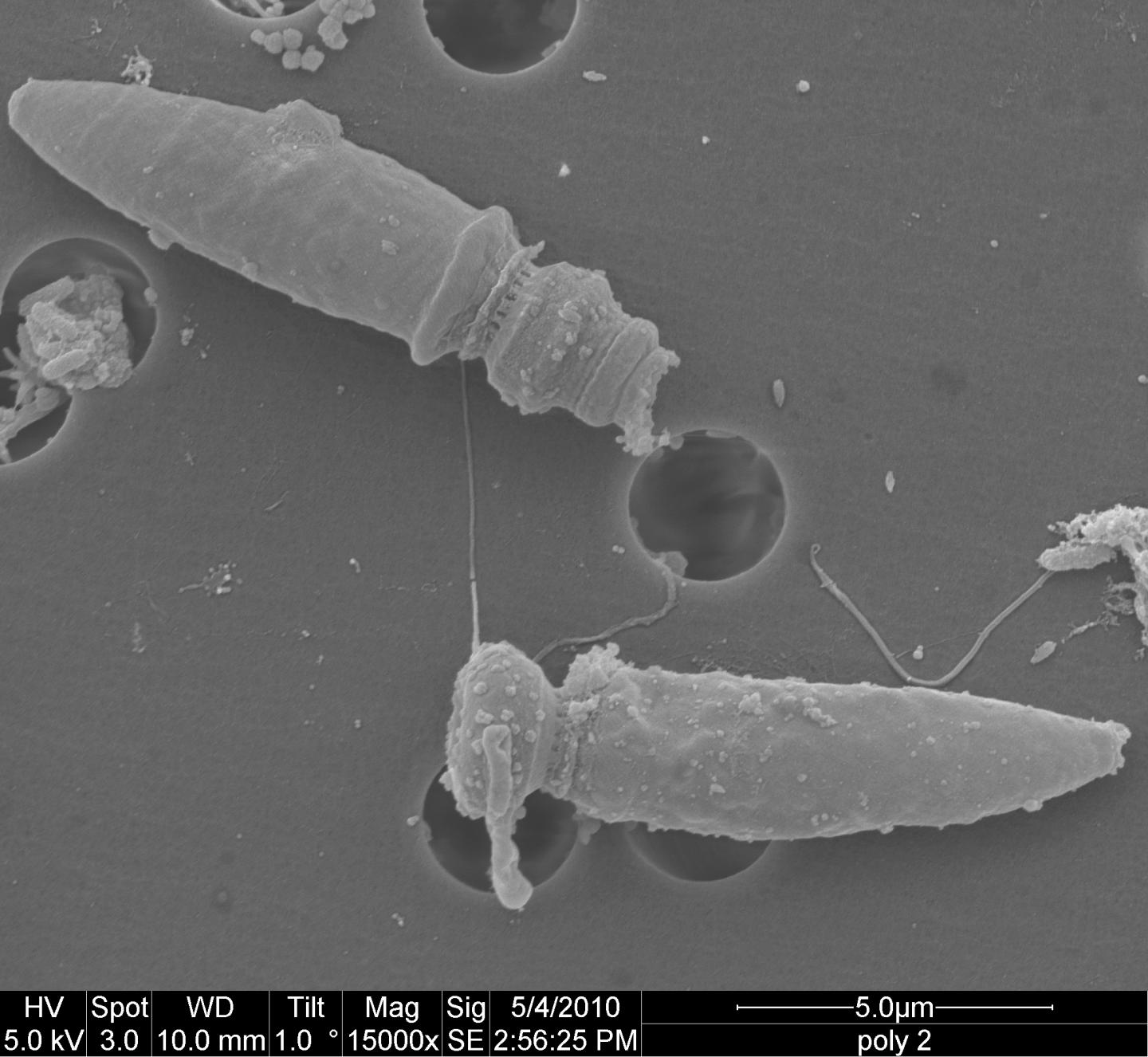 Evolution of Complex Ballistic 'Harpoons' in Microbes (9 of 11)