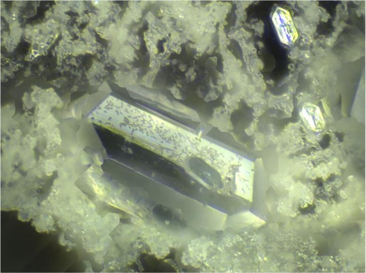 Catheter Biofilm [IMAGE] | EurekAlert! Science News Releases