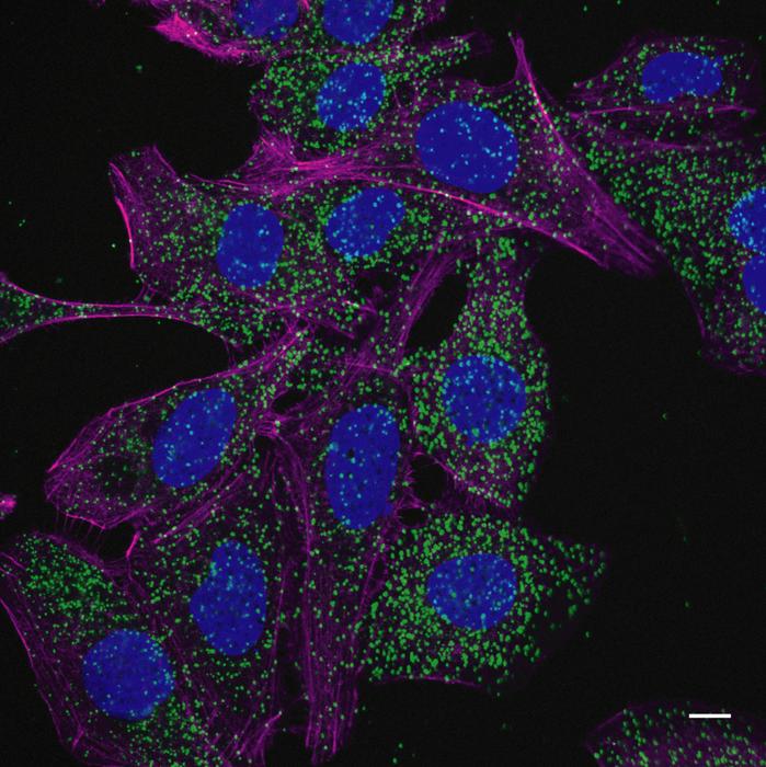 Mutated protein associated to recycling regulation