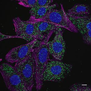 Mutated protein associated to recycling regulation