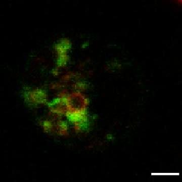Rab27a-null Cells Block HIV-1 Assembly (2 of 2)