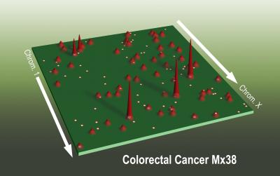Landscape of a Typical Colorectal Cancer