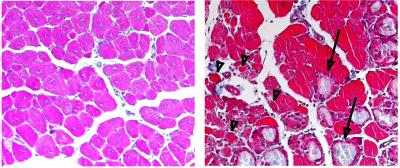 Impaired Muscle Regeneration