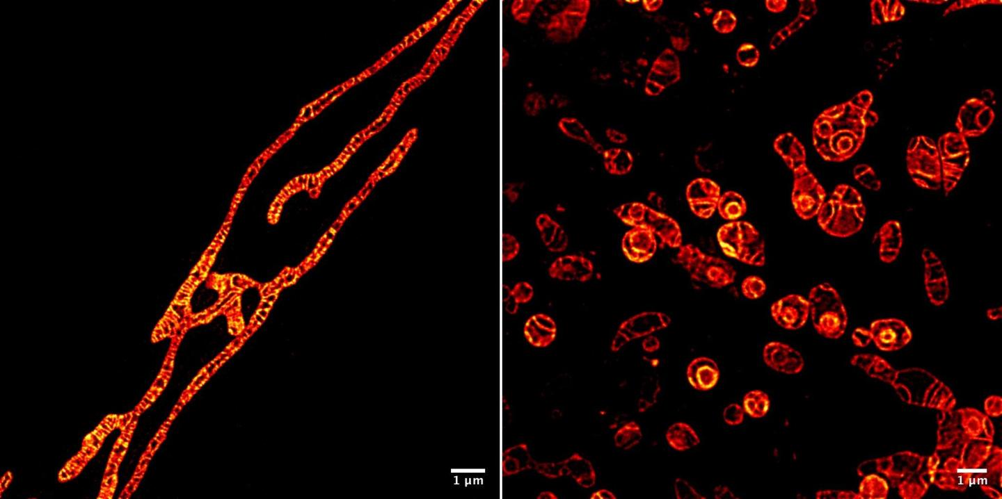 Live Mitochondria Under STED Microscope Unprecedented Detail