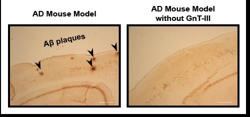 Immunostaining of Aβ Plaques in Mice with and without the Critical Enzyme