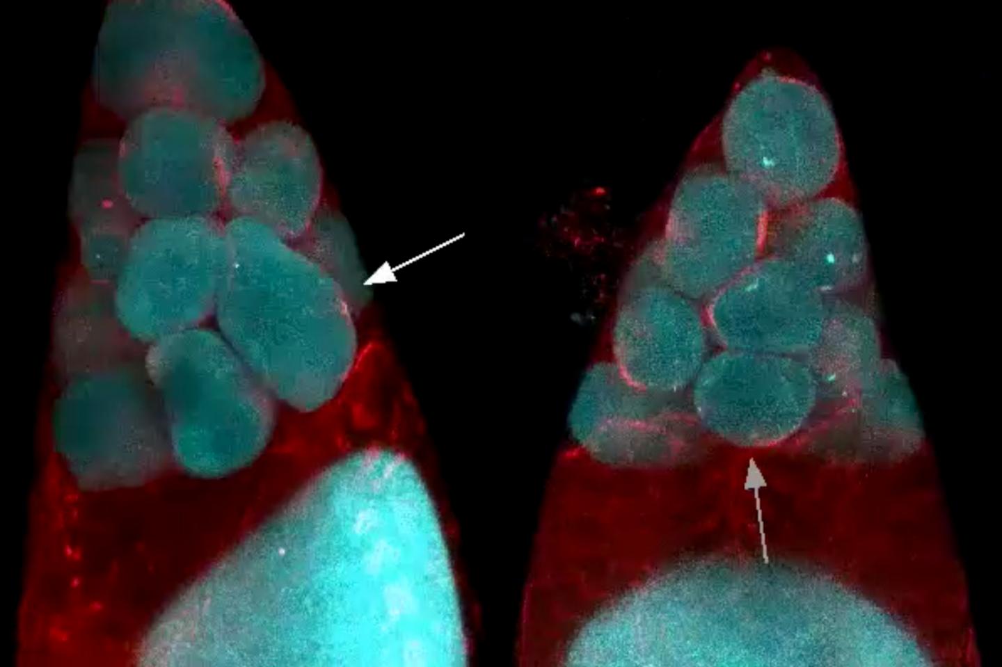 Clustered fruit fly nurse cells