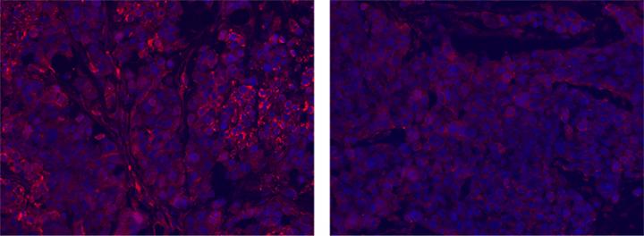 Tumor Cells With Or Without Clofazimine