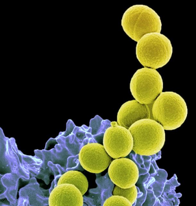 Staphylococcus aureus bacteria