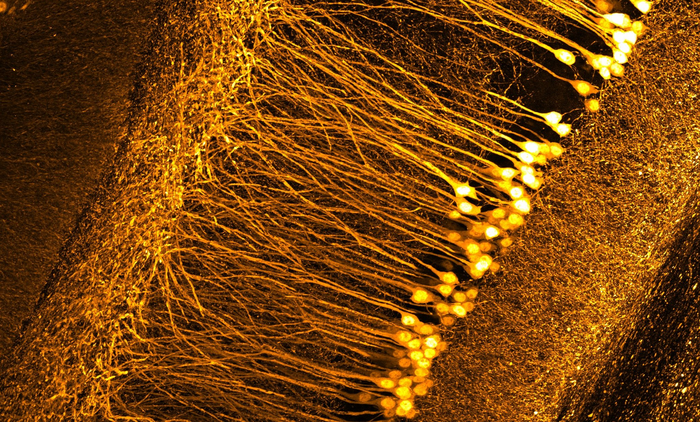 The Schmidt objektive produces detailed images of neurons in a mouse brain.