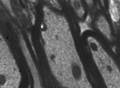 After 21 Days of Kaixin Jieyu Fang Administration