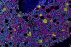 Multiplex immunofluorescence image of a normal bone marrow core biopsy tissue from a teenage individual