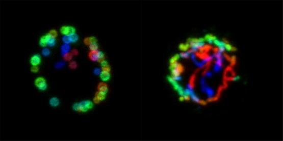 Young vs an Old T Cell