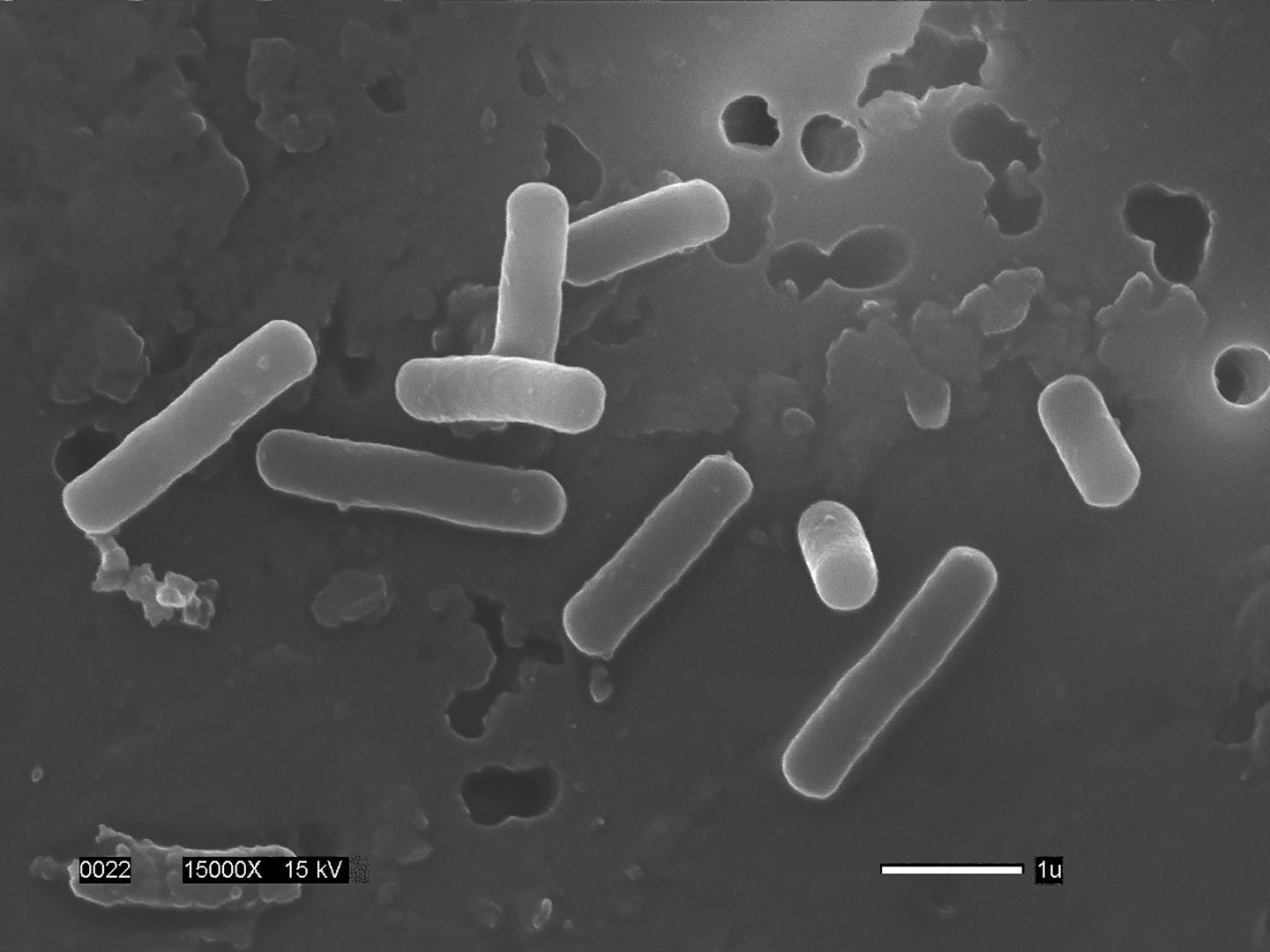 Electron micrograph of the intestinal bacterium Lactobacillus gasseri