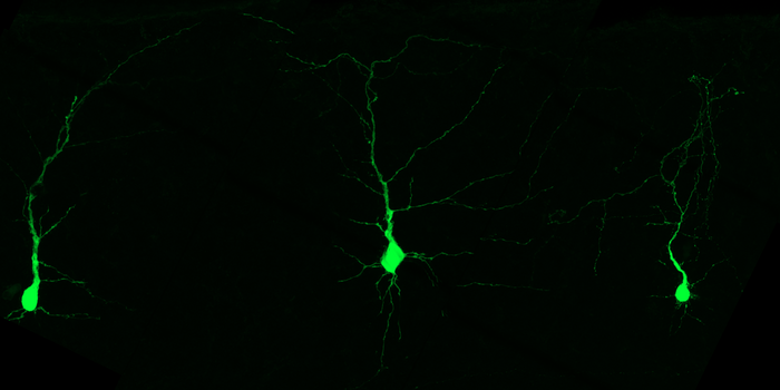 Neurons of the cortexthe brains outermost layer