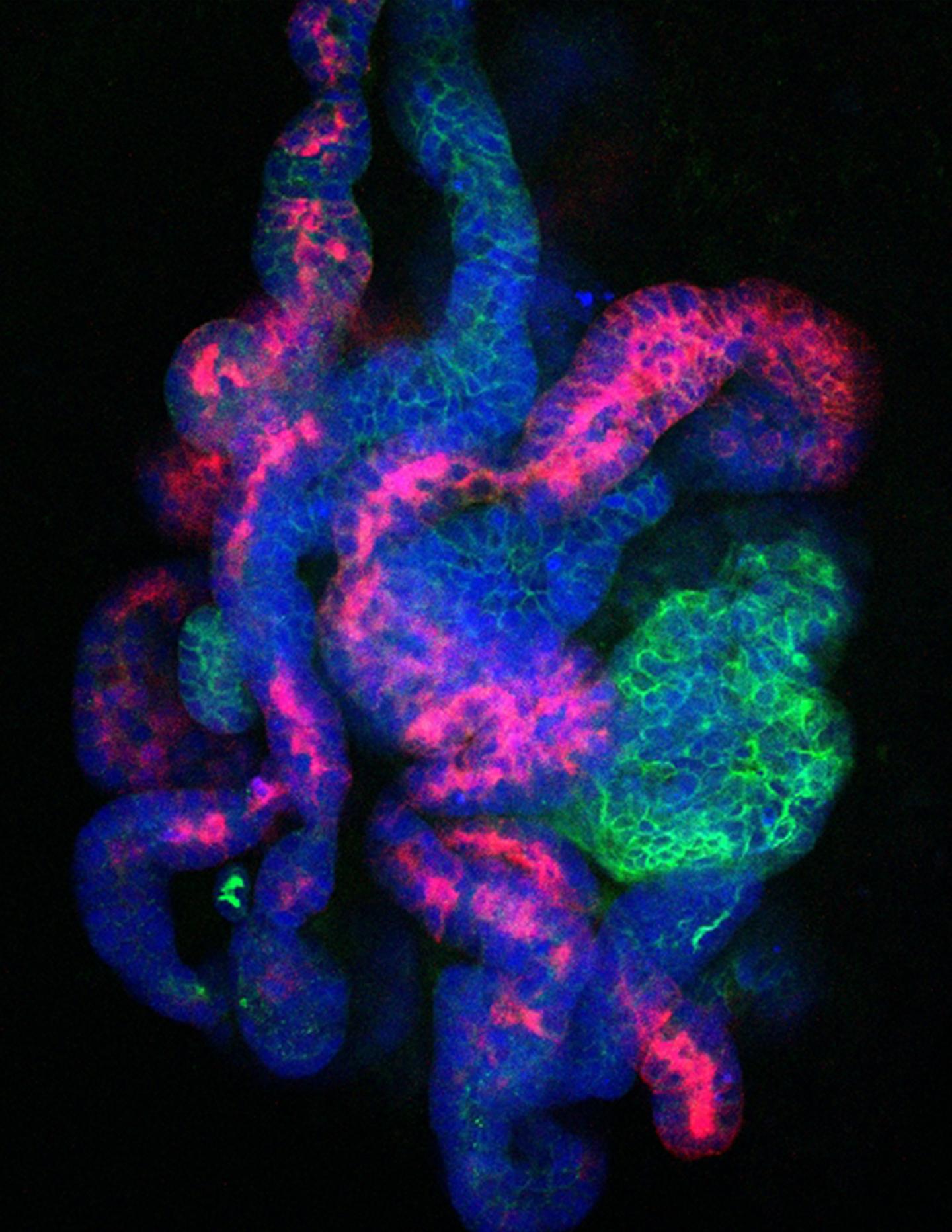 New Method Creates Endless Supply of Kidney Precursor Cells