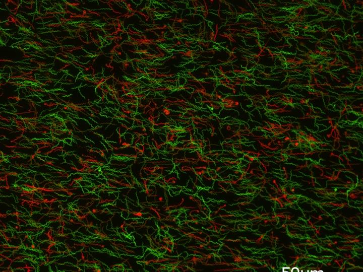 Lyme Disease Bacteria