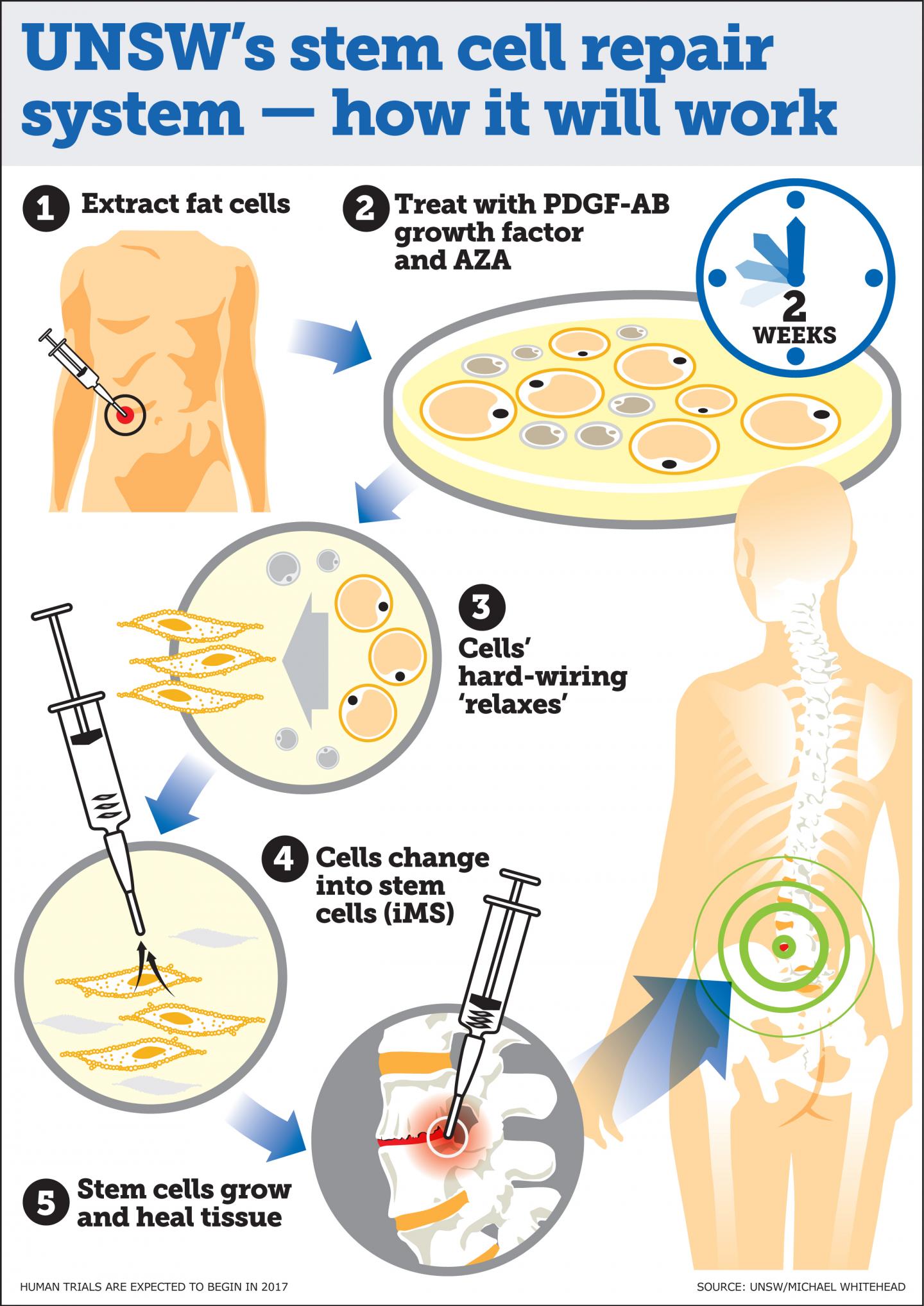 UNSW's Stem Cell Repair System: How It Will Work