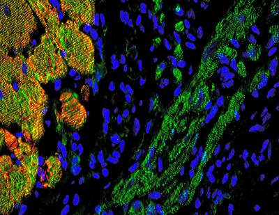 Engineered Tissue Pacemaker Substitute