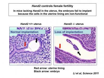 What's Behind Progesterone's Benefits in the Uterus? (2 of 2)