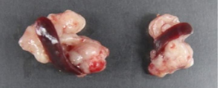 Halting Tumor Growth