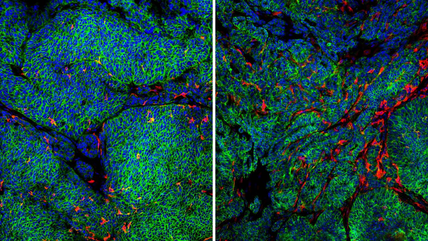 Photomicrographs of Mouse Tumors