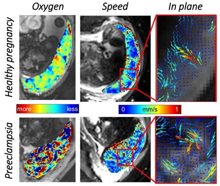 Imaging Reveals Unexpected Contractions in the Human Placenta